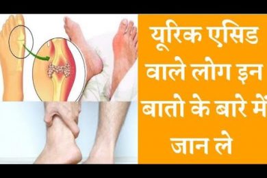 Uric acid symptoms reason and diet यूरिक एसिड से परेशान हैं तो जरूर जान ले ये बाते