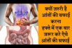 Clean the stomach and intestines कैसे करे आंतों की सफाई जाने