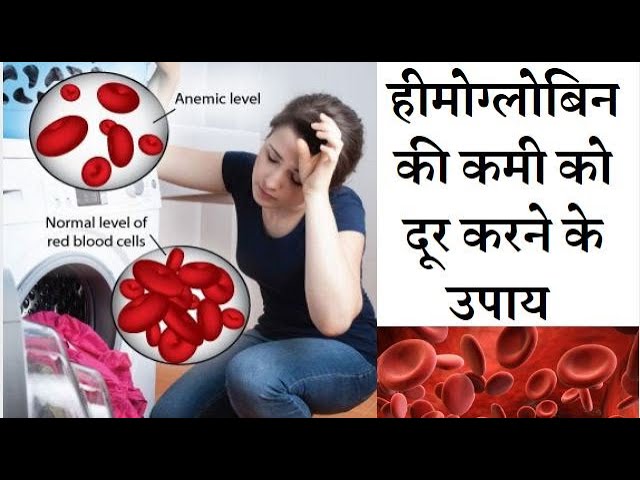 Natural ways to Increase hemoglobin count easily