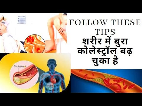 इन संकेतों से जाने की आपके शरीर में बुरा कोलेस्ट्रॉल बढ़ चुका है Bad cholesterol increased your body