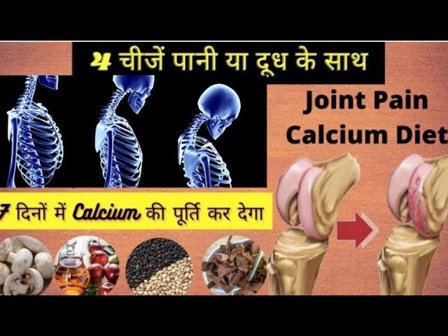 Treatment of strengthening Bones हड्डियों को मजबूत कैसे बनाएं