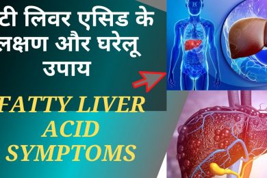 Fatty liver diseases | कही आप को फैटी लिवर तो नहीं ? | Best Treatment of Fatty Liver
