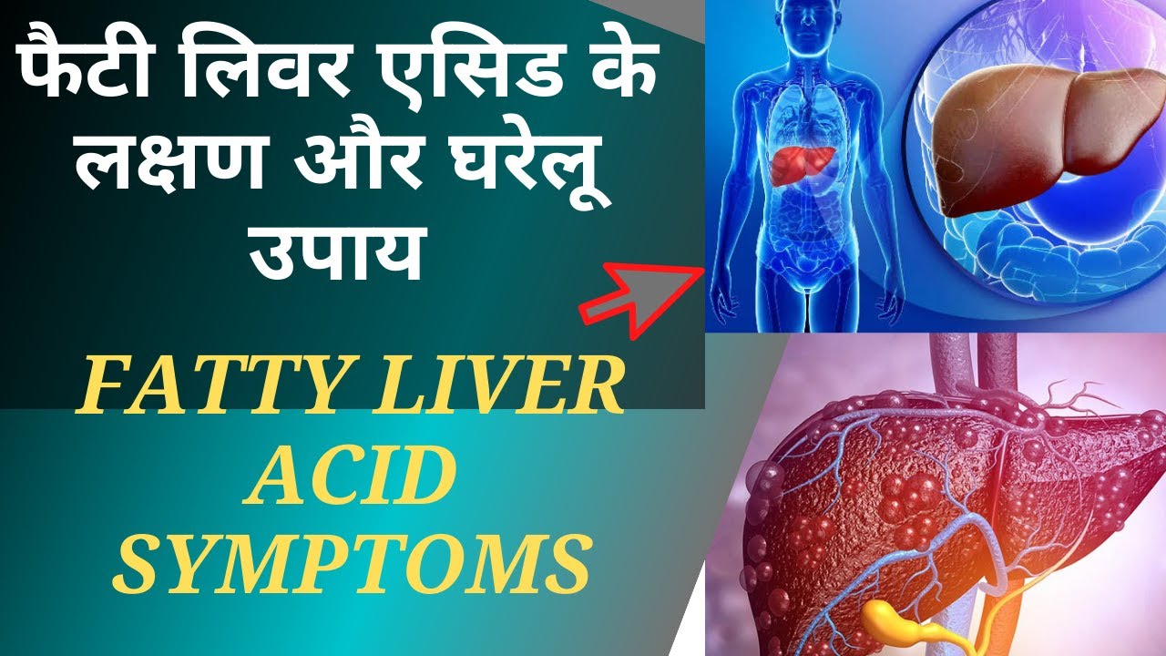 Fatty liver diseases | कही आप को फैटी लिवर तो नहीं ? | Best Treatment of Fatty Liver