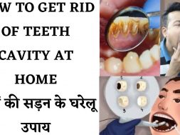 (Tooth Decay) Remedies To Remove Tooth Cavity दांतों की सड़न को दूर करने के लिए अपनाएं ये घरेलू उपाय