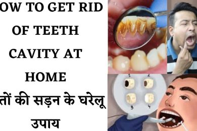 (Tooth Decay) Remedies To Remove Tooth Cavity दांतों की सड़न को दूर करने के लिए अपनाएं ये घरेलू उपाय