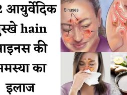 Ayurvedic treatment for sinus सायनस से हैं परेशान तुरंत अपनाएं ये देसी इलाज, होगा फायदा Nazla zukam
