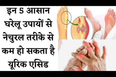 How to Reduce Uric Acid || यूरिक एसिड को हमेशा के लिए कैसे ठीक करें || Gout Remedies