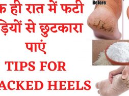 Home Remedies for Cracked Heels / जानें फटी एड़‍ियां ठीक करने के उपाय