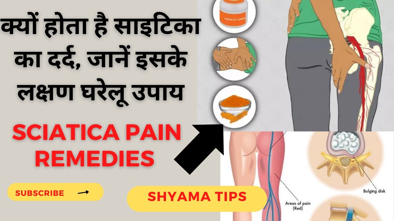 Home Remedies for Sciatica | साइटिका के दर्द में आराम देगा यह 2 घरेलु उपाय | Sciatica in Hindi