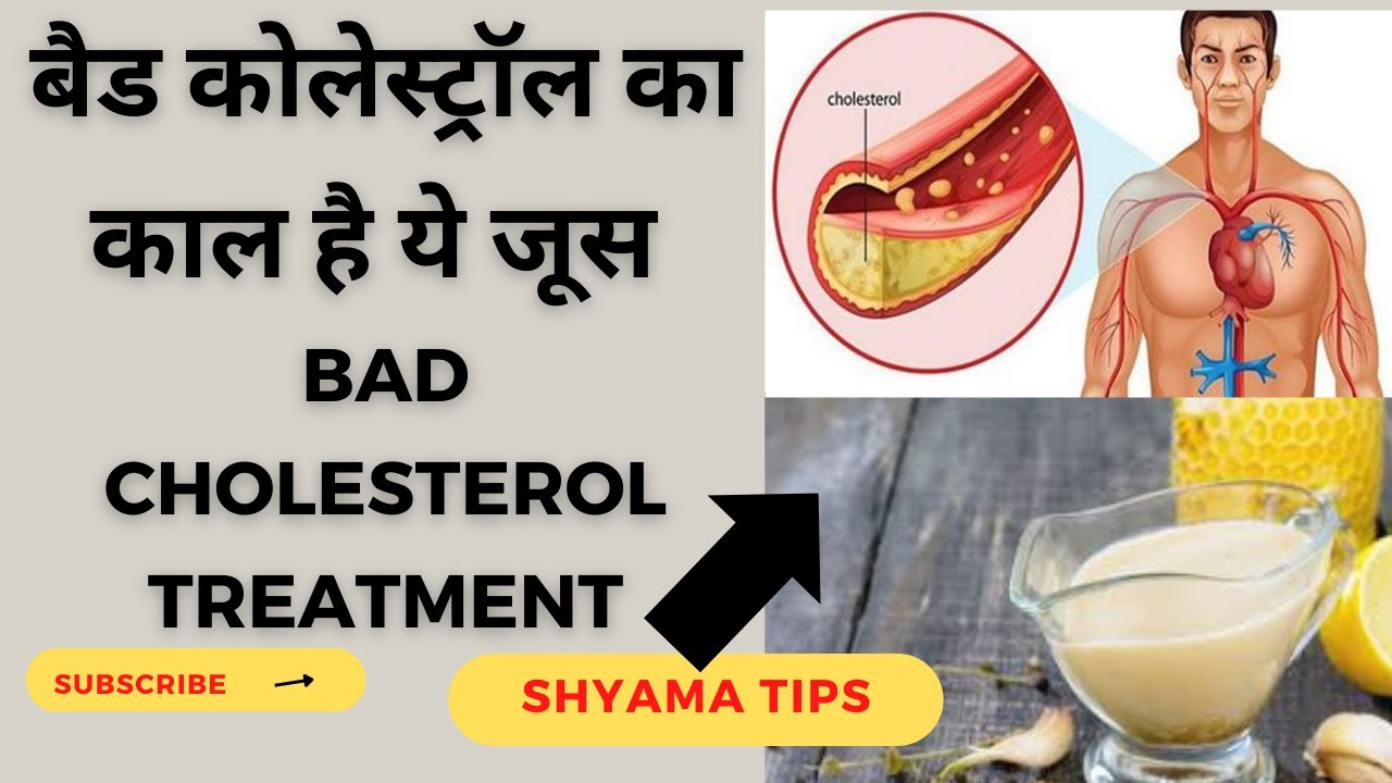 लहसन और नींबू से कोलेस्ट्रॉल को खत्म करे | MAGICAL BENEFITS OF GARLIC & LEMON JUICE |Bad Cholesterol