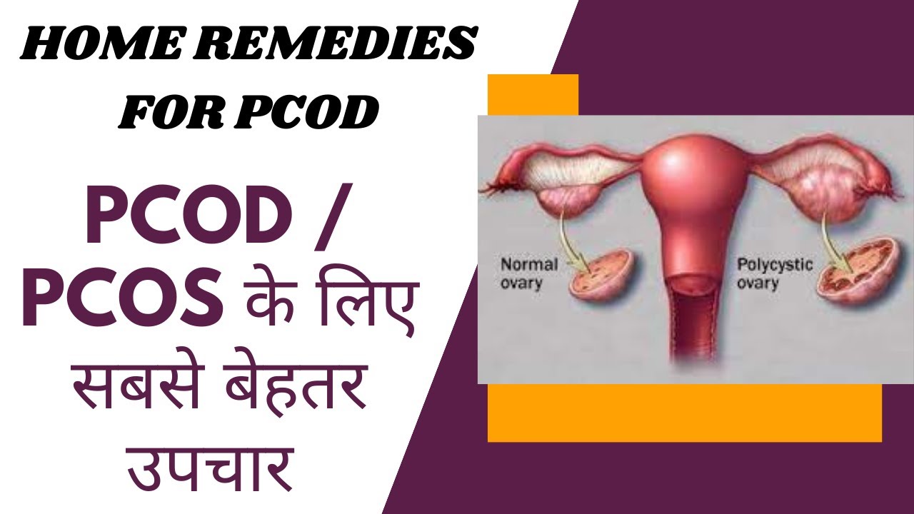 PCOD  PCOS जड़ से खत्म कैसे करें   PCODPCOS में क्या खाएं क्या नहीं खाए